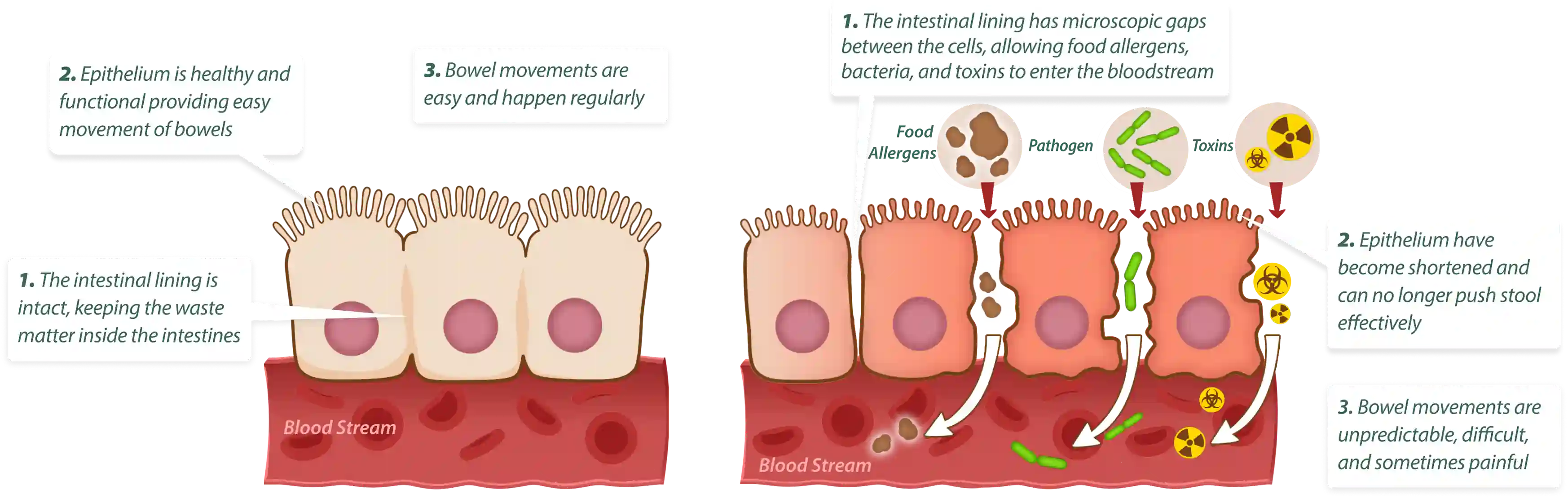 How EmmaRelieg works – 3-step gut cleansing and healing process