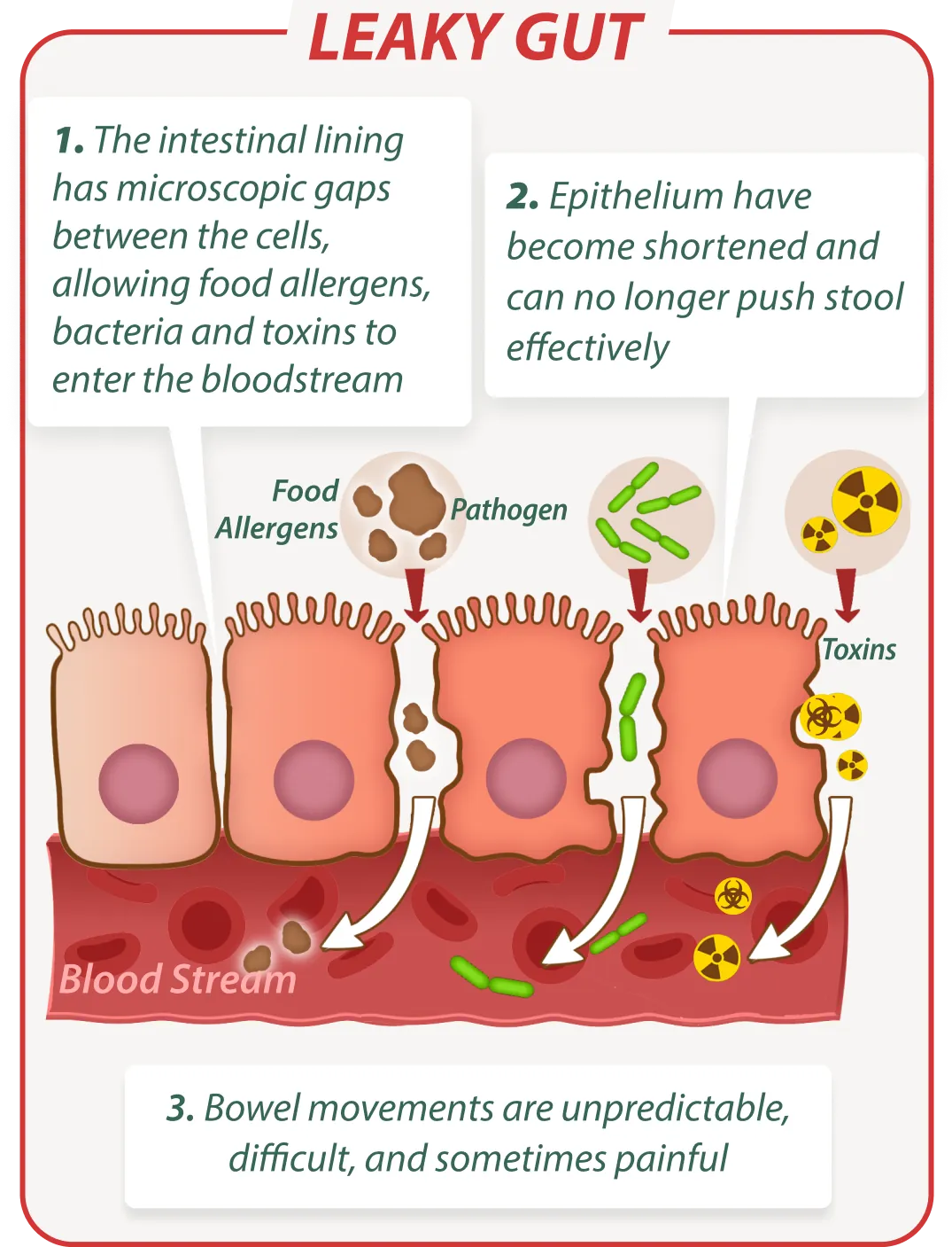 Leaky gut without EmmaRelieg – digestive issues illustration